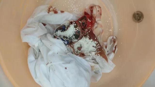 O2泡使用轻松泡除血渍! O2泡使用轻松泡除血渍!